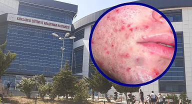 Kırklareli Eğitim ve Araştırma Hastanesi'nden Mesai Dışı Cildiye Polikliniği Hizmeti