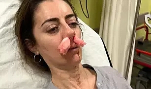 Kendisini eşinin sevgilisi zanneden kadın tarafından darbedildi